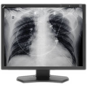 21" Grayscale 3-Megapixel Medical Diagnostic Monitor